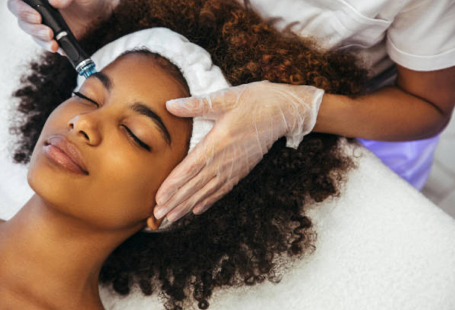 Microneedling (Face)